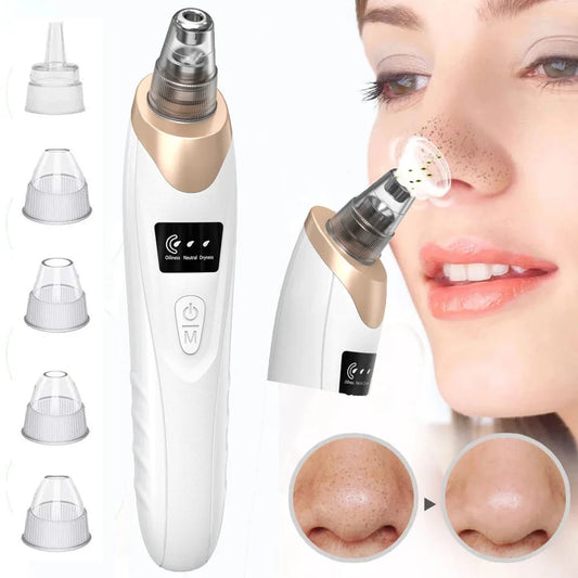 Blackhead Remover Tool – Deep Pore Cleansing Device